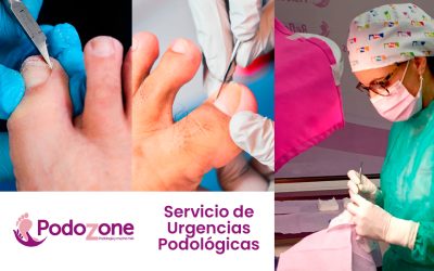 Servicio de podología de urgencias en Málaga capital
