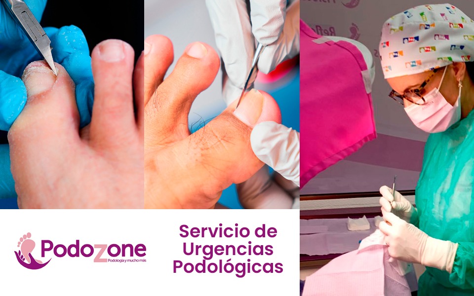 Servicio de podología de urgencias en Málaga capital