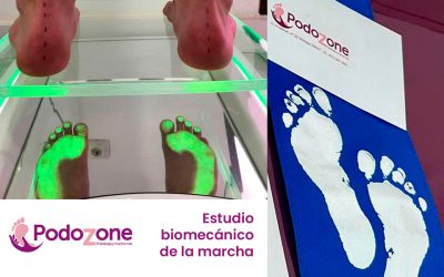 Estudio biomecánico de la marcha: qué es y cómo mejora tu salud al caminar