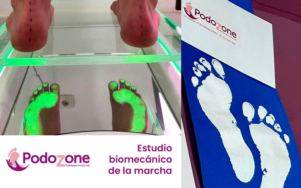 Estudio biomecánico de la pisada en Málaga capital