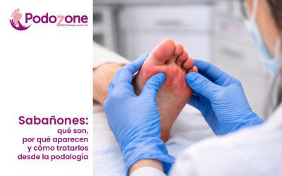 Sabañones: qué son, por qué aparecen y cómo tratarlos desde la podología
